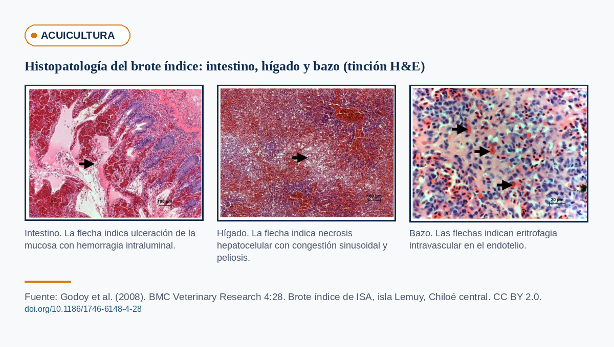 Histopatología de anemia infecciosa del salmón: cortes con tinción hematoxilina-eosina de intestino, hígado y bazo mostrando ulceración mucosa, necrosis hepatocelular con peliosis y eritrofagia endotelial