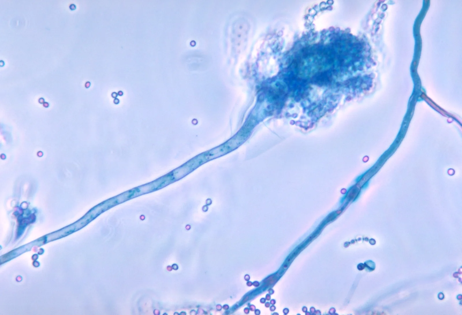 Conidióforo de Aspergillus fumigatus, la estructura que produce las esporas que inhalan las aves.