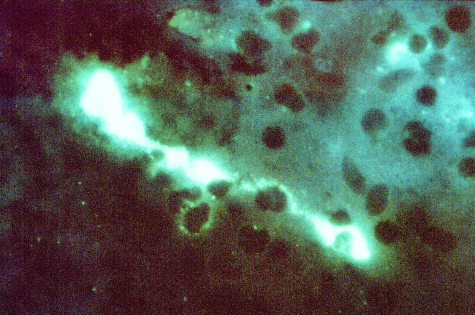 Chlamydia psittaci en un frotis de impronta teñido con inmunofluorescencia directa (400X).