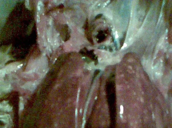 Focos de necrosis en el hígado de un gallo, en un brote de cólera aviar en reproductoras (Marruecos).
