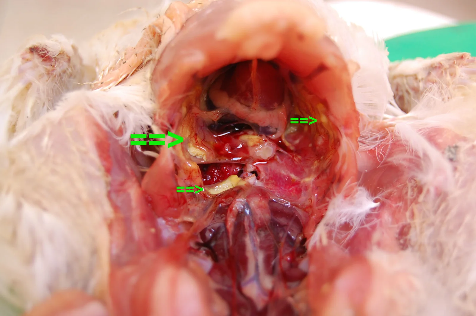 Aerosaculitis y pleuritis fibrinosas en un pollo con colibacilosis (flechas).