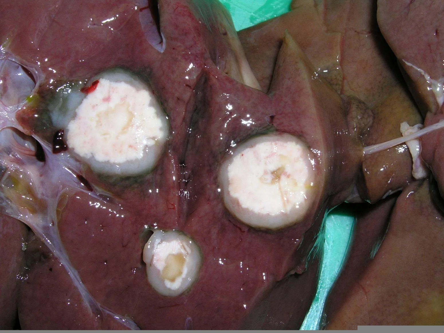 Coligranulomas en el hígado de una gallina.