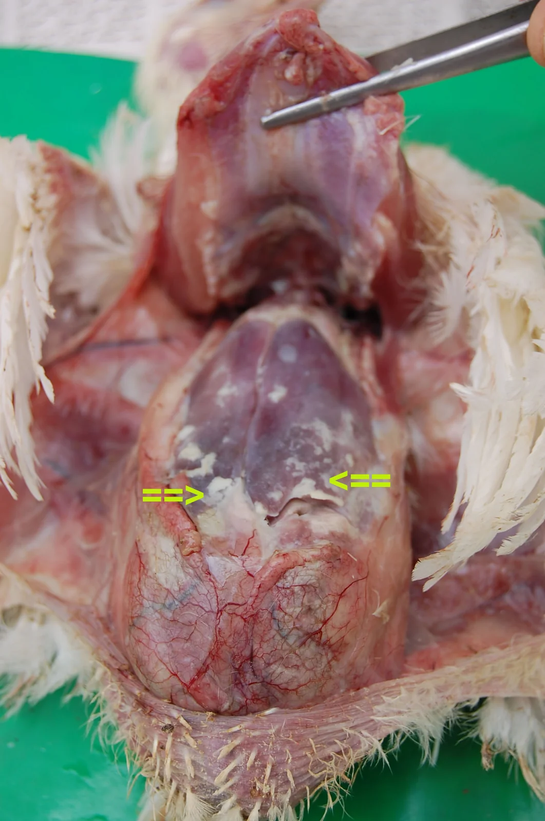 Perihepatitis fibrinosa en un pollo con colibacilosis: capa de fibrina sobre el hígado (flechas).
