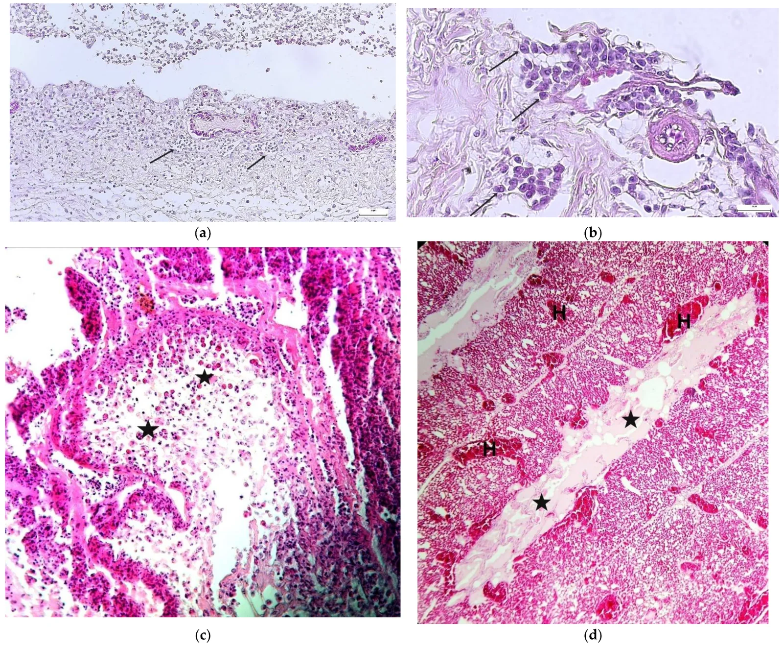 Histopatología del mismo brote: exudado fibrinoso con infiltrado linfocitario en la tráquea (a), célula sincitial con cuerpos de inclusión intranucleares en la laringe (b), descamación del epitelio traqueal (c) e hiperemia y edema del pulmón (d).