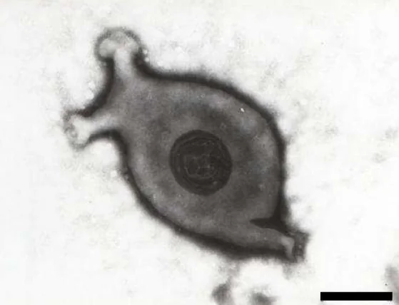 Mycoplasma gallisepticum al microscopio electrónico con tinción negativa. Barra: 140 nm.