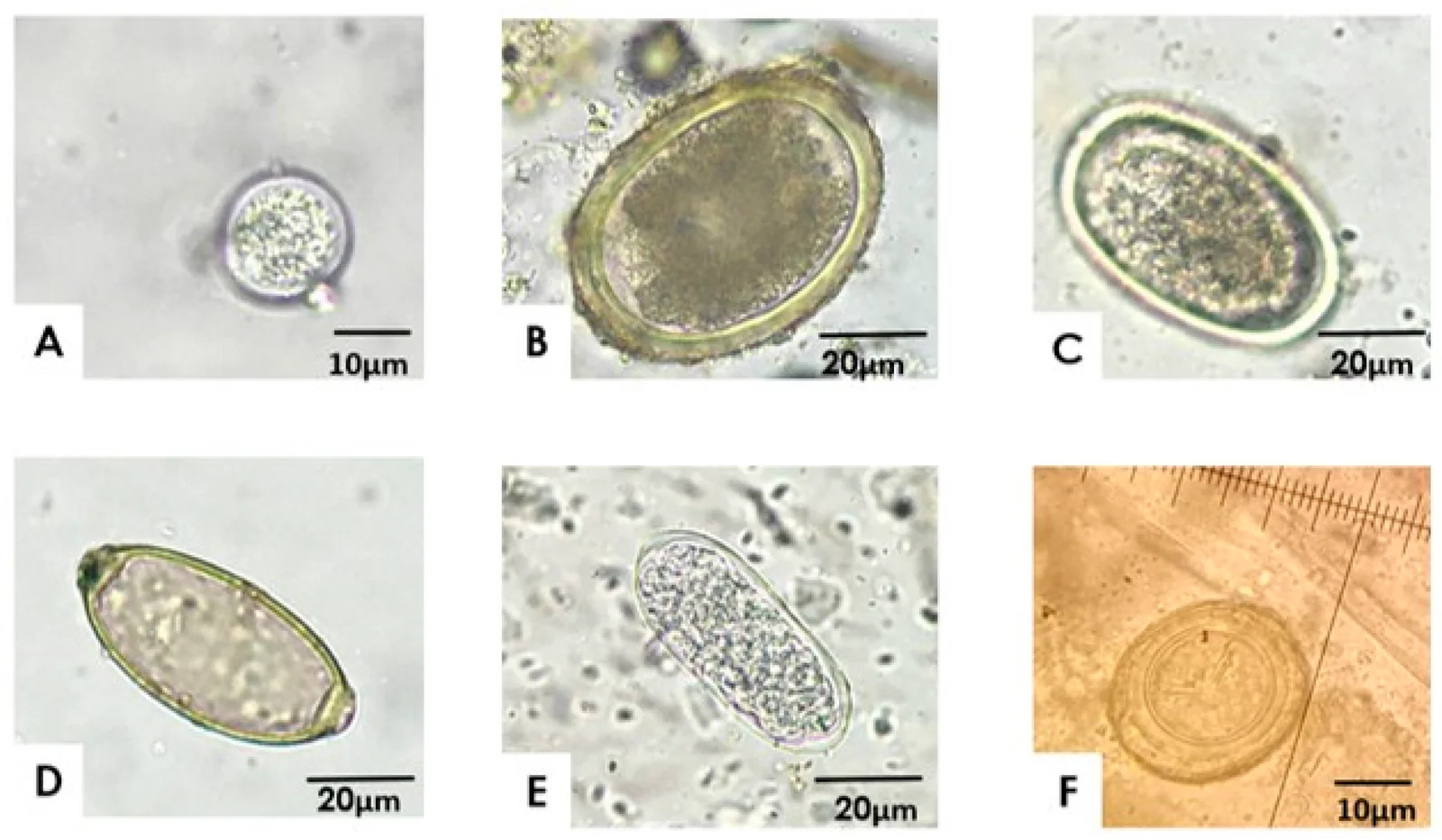 Parásitos gastrointestinales en traspatios de Chile central (400X): ooquistes de Eimeria (A), huevos de Ascaridia galli (B), Heterakis gallinarum (C), Capillaria (D), Trichostrongylus (E) y un huevo de tipo cestodo (F).
