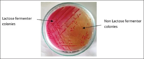 Colonias de Salmonella Gallinarum en agar MacConkey, aisladas de un brote de tifosis en gallinas de postura en la India.