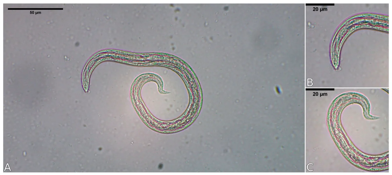 Larva de primer estadio de Aelurostrongylus spp. obtenida con el método de Baermann de un visón americano del sur de Chile (40x). Es la misma forma que se busca en las heces del gato.