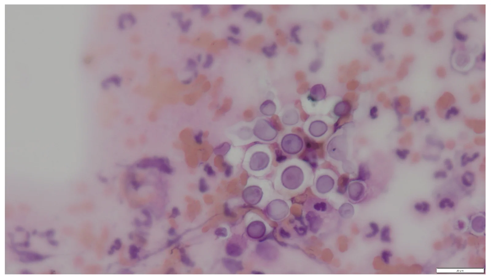Citología por punción de la nariz de un gato: numerosas levaduras redondas y ovaladas con una cápsula gruesa que no se tiñe (HE, 600x, barra de 20 µm).