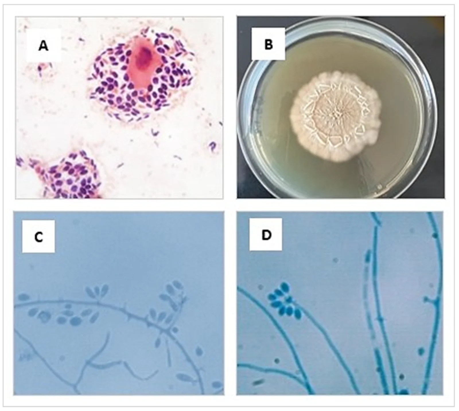 Diagnóstico de S. brasiliensis en un gato de Magallanes. (A) Citología de una úlcera con muchas levaduras (Gram, 1000×). (B) Colonias en agar Sabouraud a los 10 días. (C, D) Hifas y conidias en microcultivo (azul de lactofenol, 1000×).