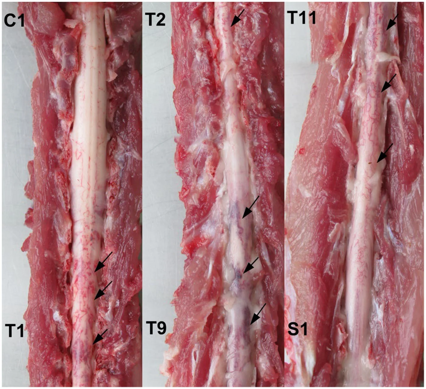 Médula espinal de un gato con Gurltia paralysans en la necropsia: varias zonas de congestión bajo las meninges (flechas) en los segmentos cervicotorácicos, torácicos y lumbares.