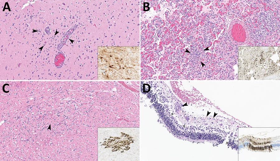 Lesiones en gatos de lecherías de Texas infectados con H5N1: encefalitis con necrosis neuronal (A), neumonía intersticial (B), miocarditis (C) y retinitis (D). En los recuadros, el antígeno viral se tiñe de café por inmunohistoquímica.