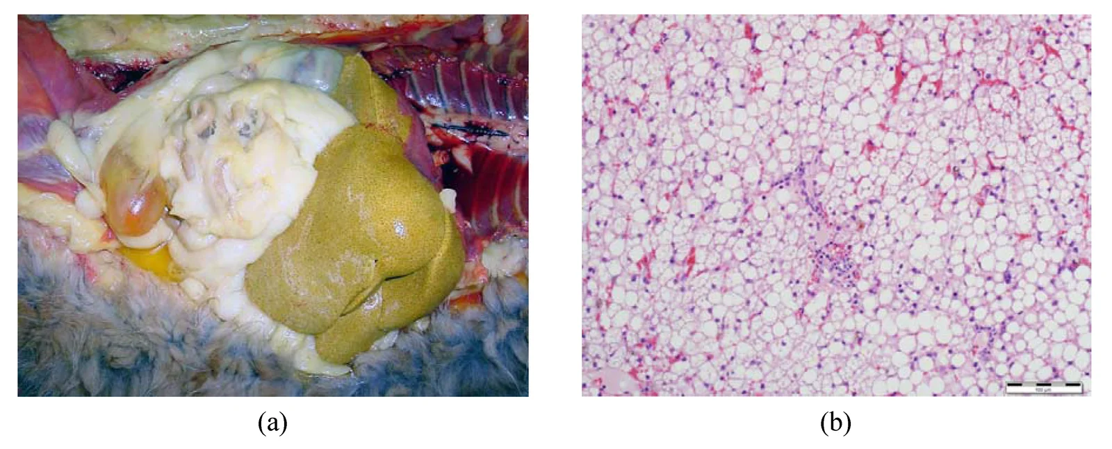 Hígado de un gato obeso con lipidosis hepática. (a) En la necropsia, el hígado está aumentado de tamaño y amarillo. (b) Al microscopio, los hepatocitos están llenos de vacuolas de grasa (hematoxilina-eosina).