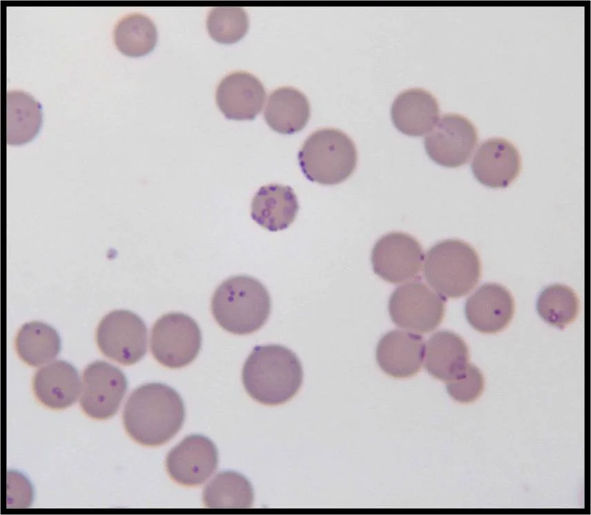 Mycoplasma haemofelis en un frotis de sangre de gato (Wright-Giemsa, 100x): pequeños puntos y cadenas de color violeta adheridos a la superficie de los glóbulos rojos.