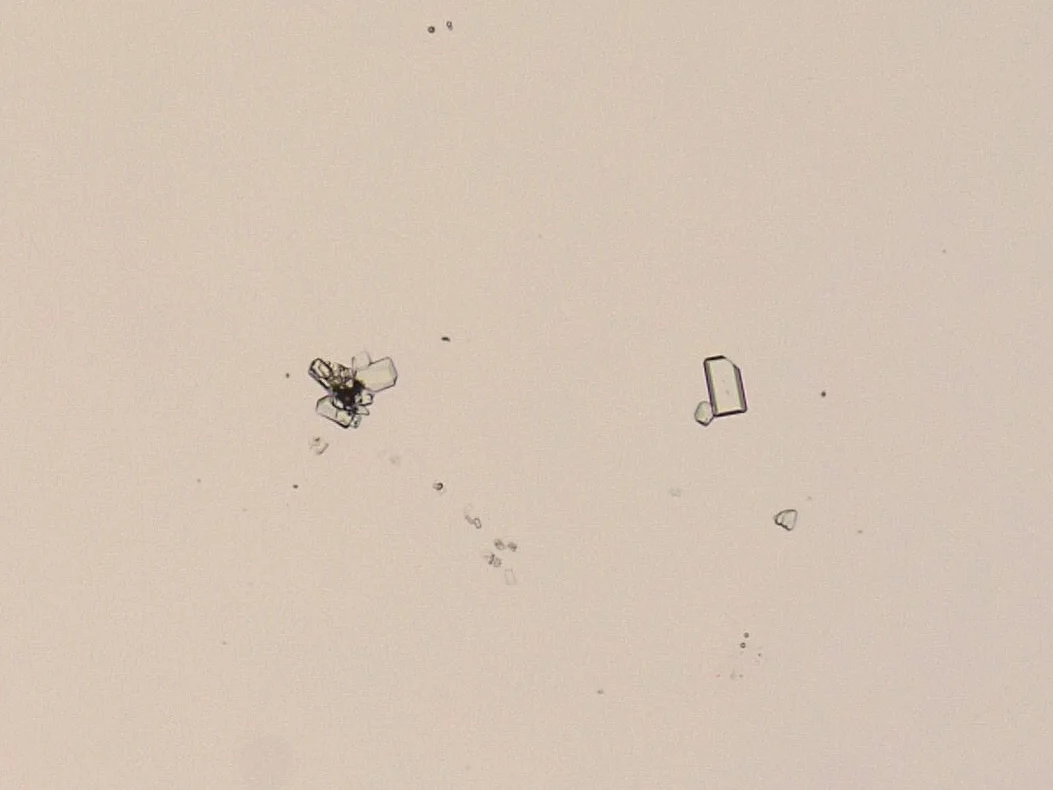 Cristales de estruvita en la orina de un gato macho castrado de 9 años, al microscopio. Los cristales no siempre acompañan a los urolitos, y pueden aparecer como artefacto si la orina se analiza tarde o refrigerada.