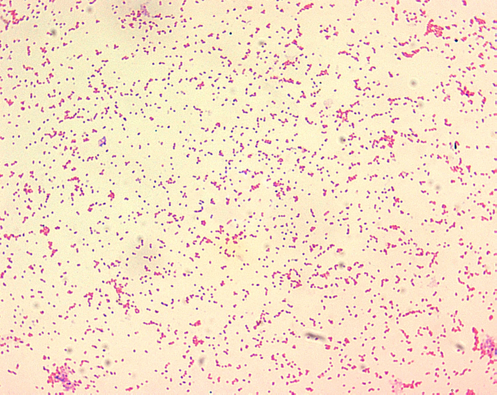 Brucella spp. con tinción de Gram: cocobacilos gramnegativos pequeños, aislados, con aspecto de arena fina.