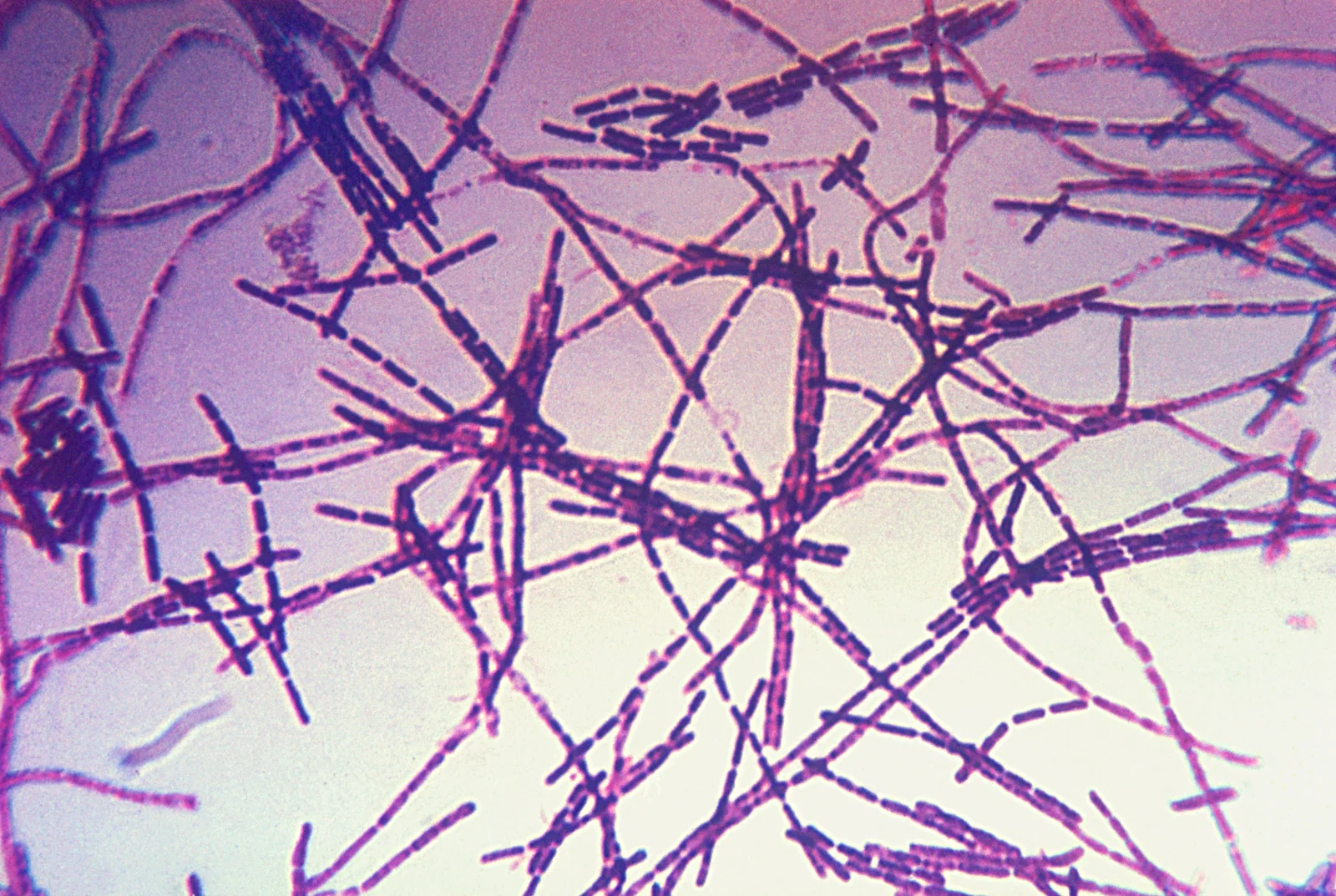 Bacillus anthracis con tinción de Gram: bacilos grampositivos grandes, en cadenas.