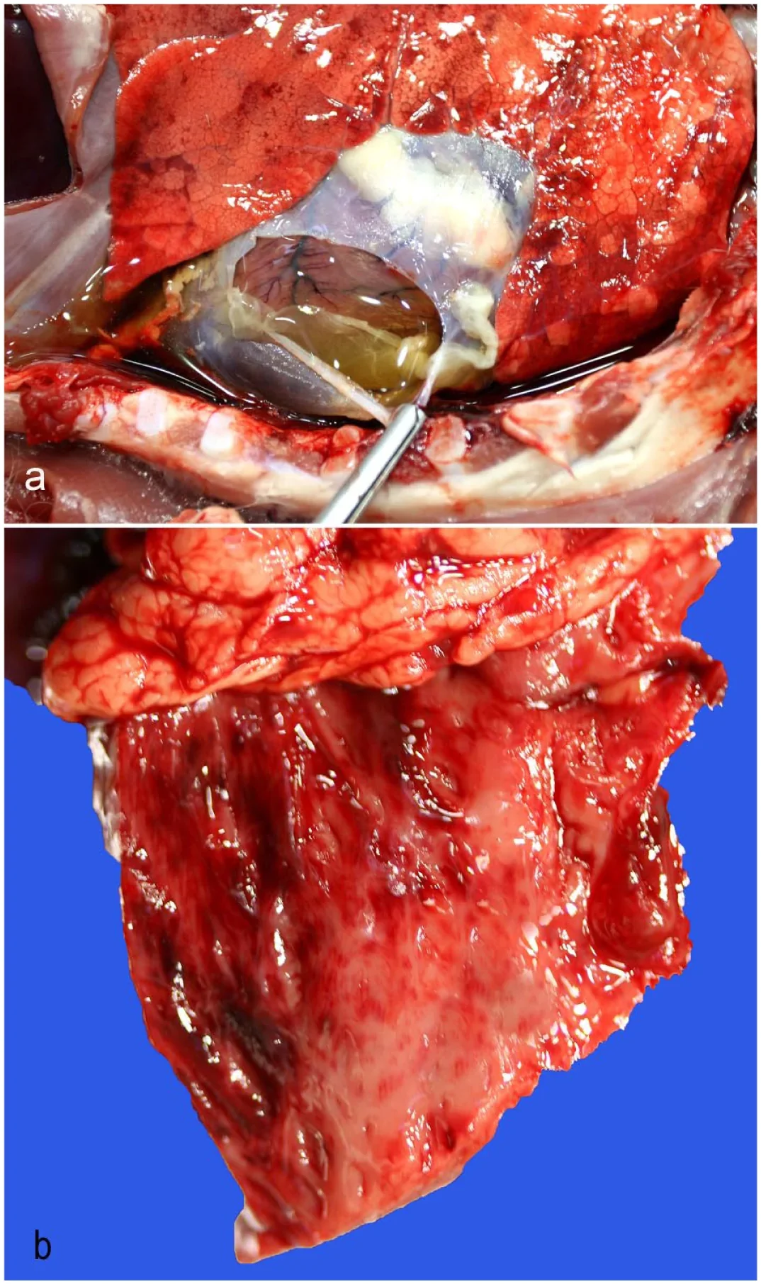 Lesiones cardíacas de enterotoxemia por C. perfringens tipo D en corderos: (a) saco pericárdico con líquido amarillo y coágulos de fibrina; (b) hemorragias endocárdicas.