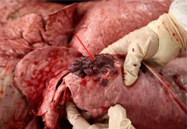 Masa tumoral en la superficie del pulmón (flecha) en una vaca con linfosarcoma confirmado por virus de la leucemia bovina.