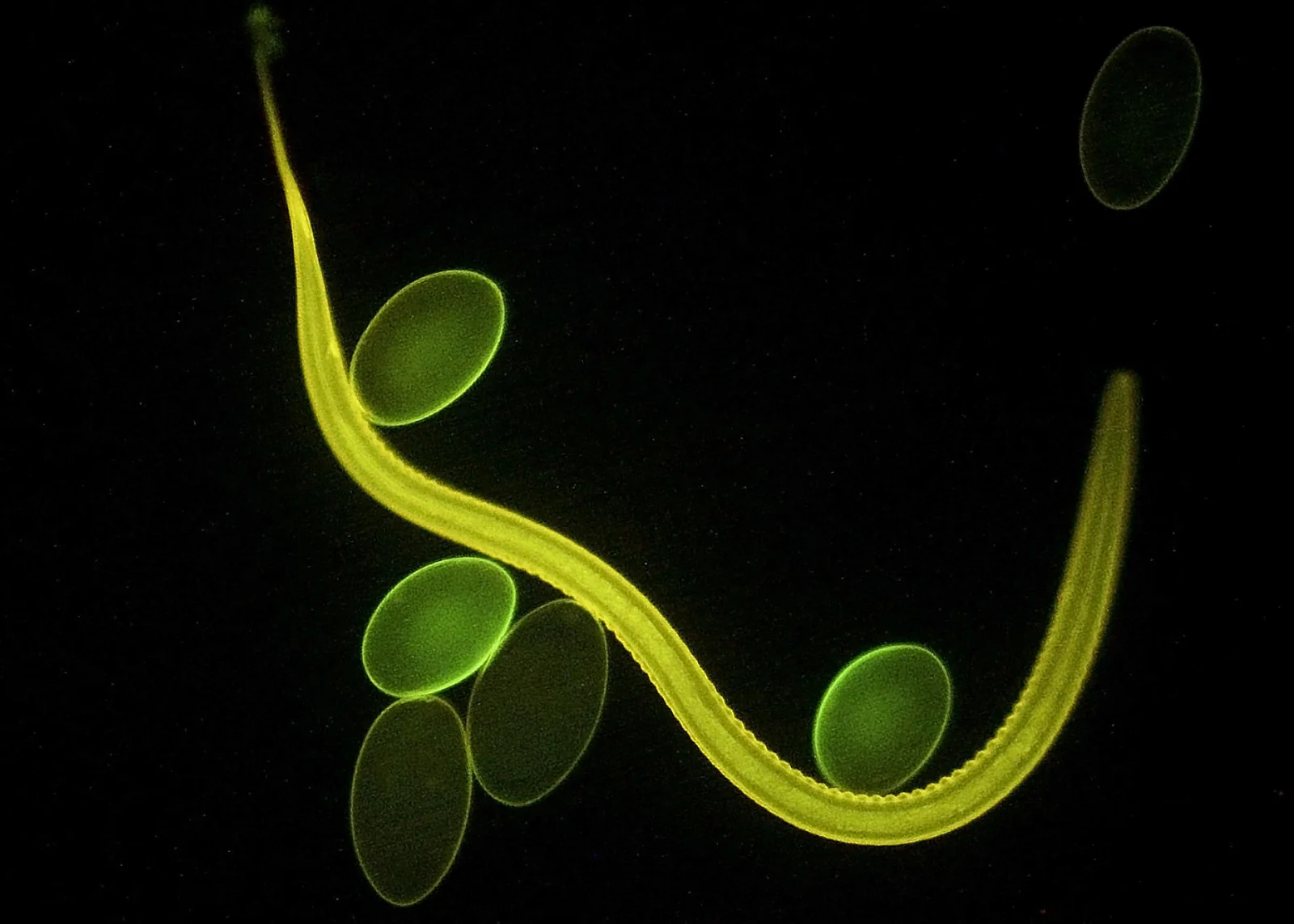 Haemonchus contortus adulto y sus huevos.