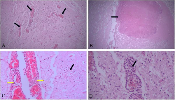 Cerebro de fetos bovinos abortados positivos a N. caninum: (A) hiperemia y manguitos perivasculares; (B) foco de necrosis; (C) infiltrado inflamatorio en meninges y astrogliosis; (D) manguito perivascular grave (H&E).