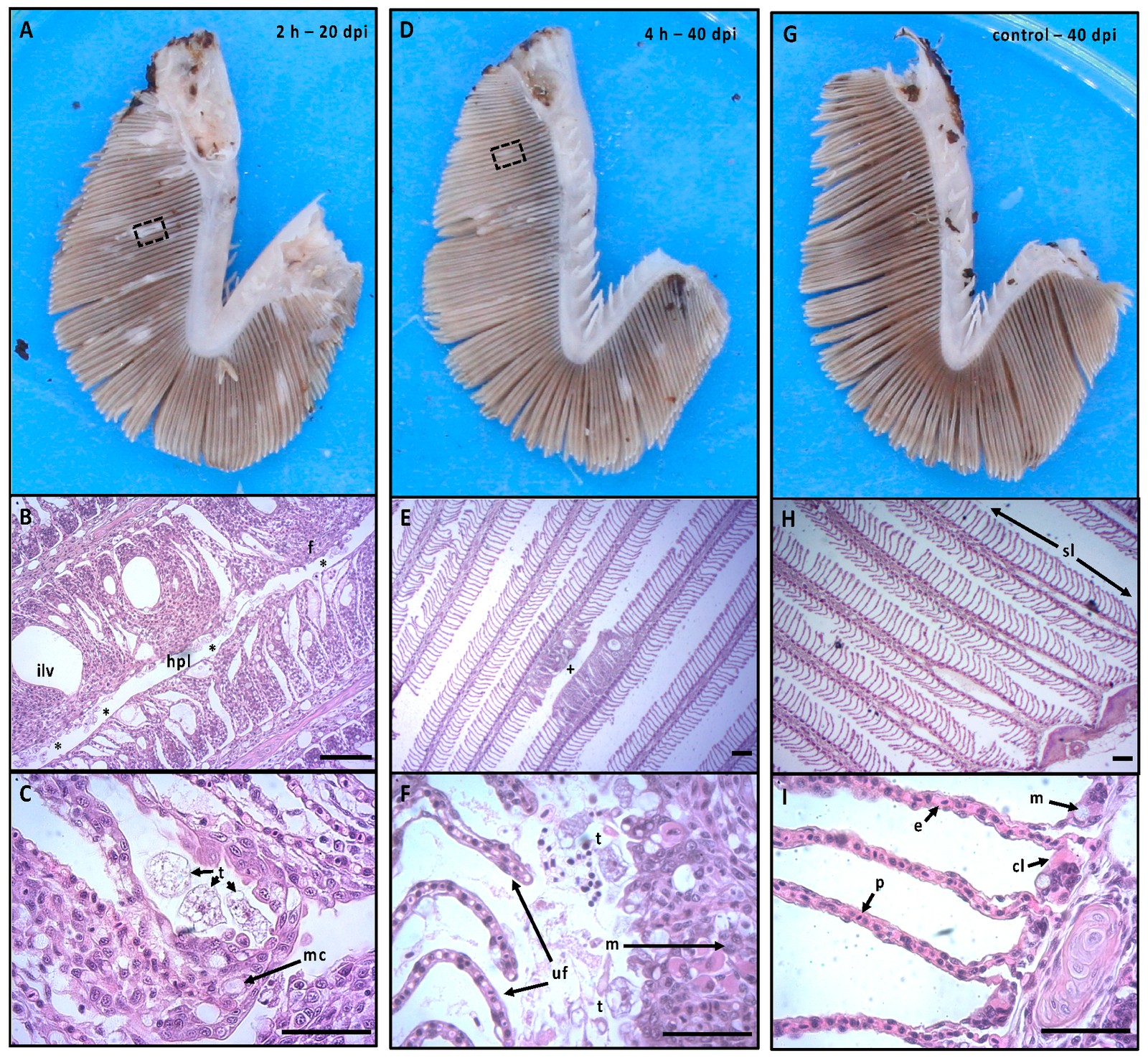 Branquias de salmón del Atlántico en un desafío con N. perurans. (A a C) Hemibranquia muy afectada, con lesiones multifocales, e histología con hiperplasia marcada, fusión de lamelas secundarias y abundantes trofozoítos. (D a F) Hemibranquia levemente afectada, con lesiones pequeñas. (G a I) Branquia control, sin lesiones.