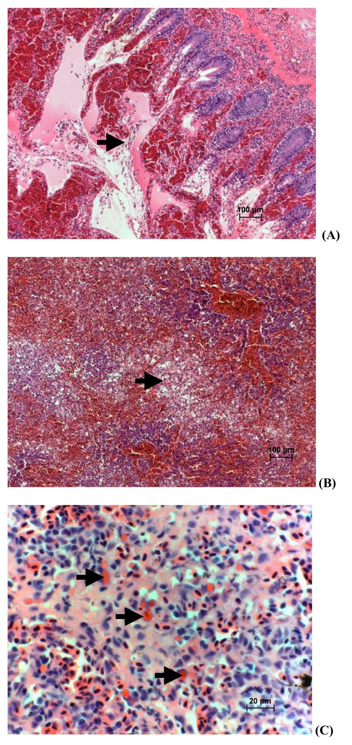 Histopatología del brote índice, tinción H&E. (A) Intestino con ulceración y hemorragia de la mucosa. (B) Hígado con necrosis de hepatocitos, hemorragia marcada y congestión sinusoidal o peliosis. (C) Bazo con eritrofagocitosis por células endoteliales.