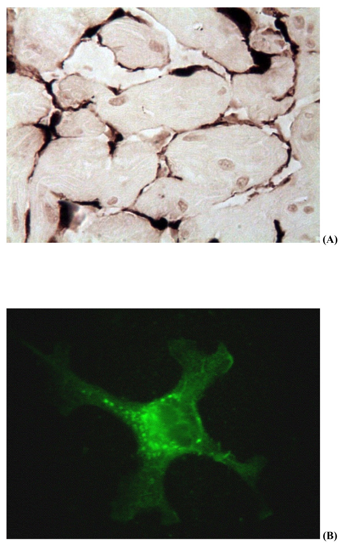 (A) Inmunohistoquímica de corazón: el color café oscuro marca el antígeno viral en las células endoteliales. (B) Aislamiento en células CHSE-214: células infectadas con fluorescencia en la prueba de IFAT con anticuerpo monoclonal contra el virus.