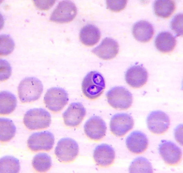 Dos trofozoítos de Babesia vogeli en un frotis de sangre de un perro con infección natural.