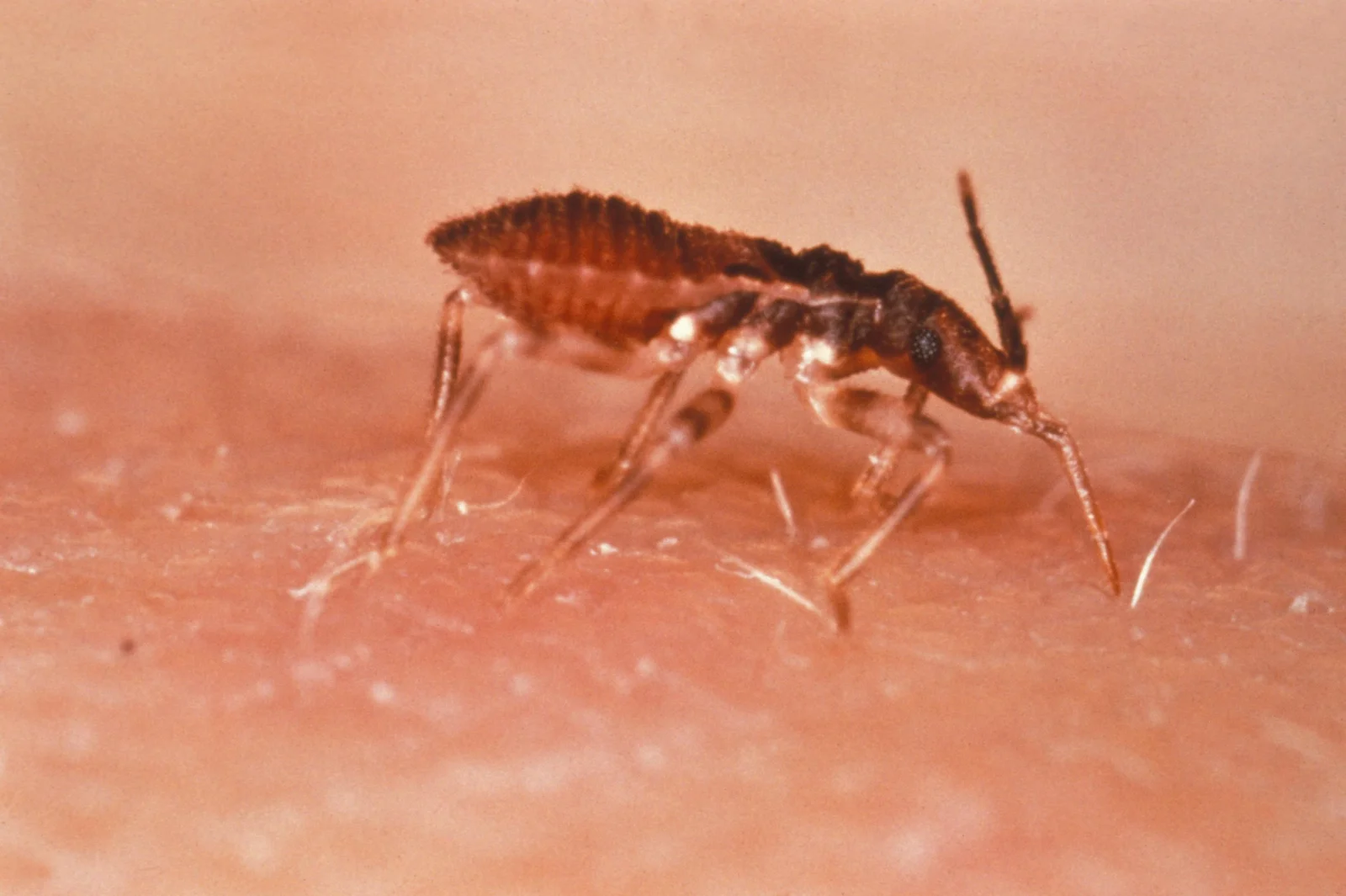 Triatoma infestans, la vinchuca, principal vector de Trypanosoma cruzi en las zonas endémicas de Chile.