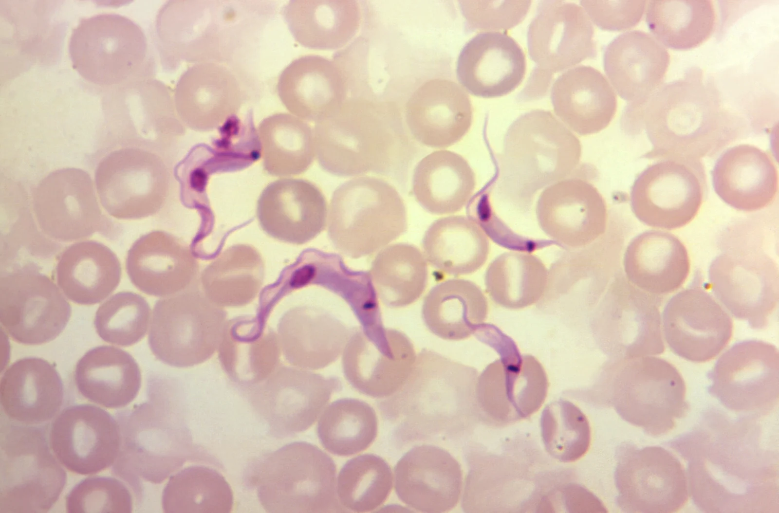 Tripomastigotes de Trypanosoma cruzi en un frotis de sangre periférica. Son más fáciles de ver en la fase aguda, cuando la parasitemia es alta.