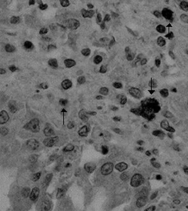 Antígeno de coronavirus canino (flechas) en tejido pulmonar de un perro infectado con una cepa pantrópica, detectado por inmunohistoquímica (×400).