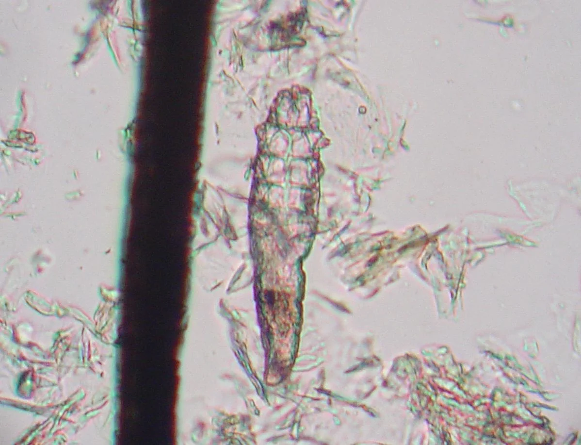 Demodex canis en un raspado de piel de un perro con demodicosis (x400). El cuerpo alargado, con forma de cigarro, y los cuatro pares de patas cortas en la parte delantera son característicos.