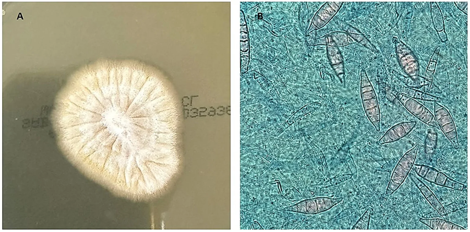 Microsporum canis aislado de un perro en Chile: colonia algodonosa y blanca después de 20 días en agar Sabouraud (A), y macroconidias fusiformes de pared gruesa y rugosa, con 6 a 15 tabiques, teñidas con azul de lactofenol (B).