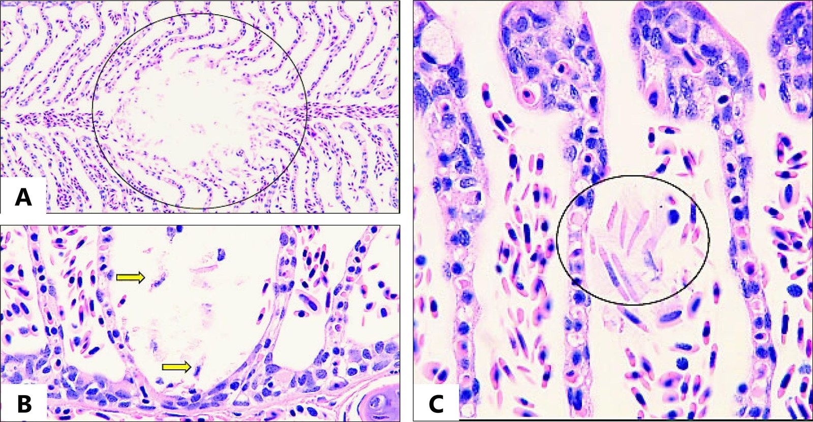 Branquia de salmón del Atlántico expuesto a Chaetoceros en laboratorio. (A) Necrosis de las lamelas (círculo). (B y C) Espinas de Chaetoceros en el tejido branquial (flecha y círculo).