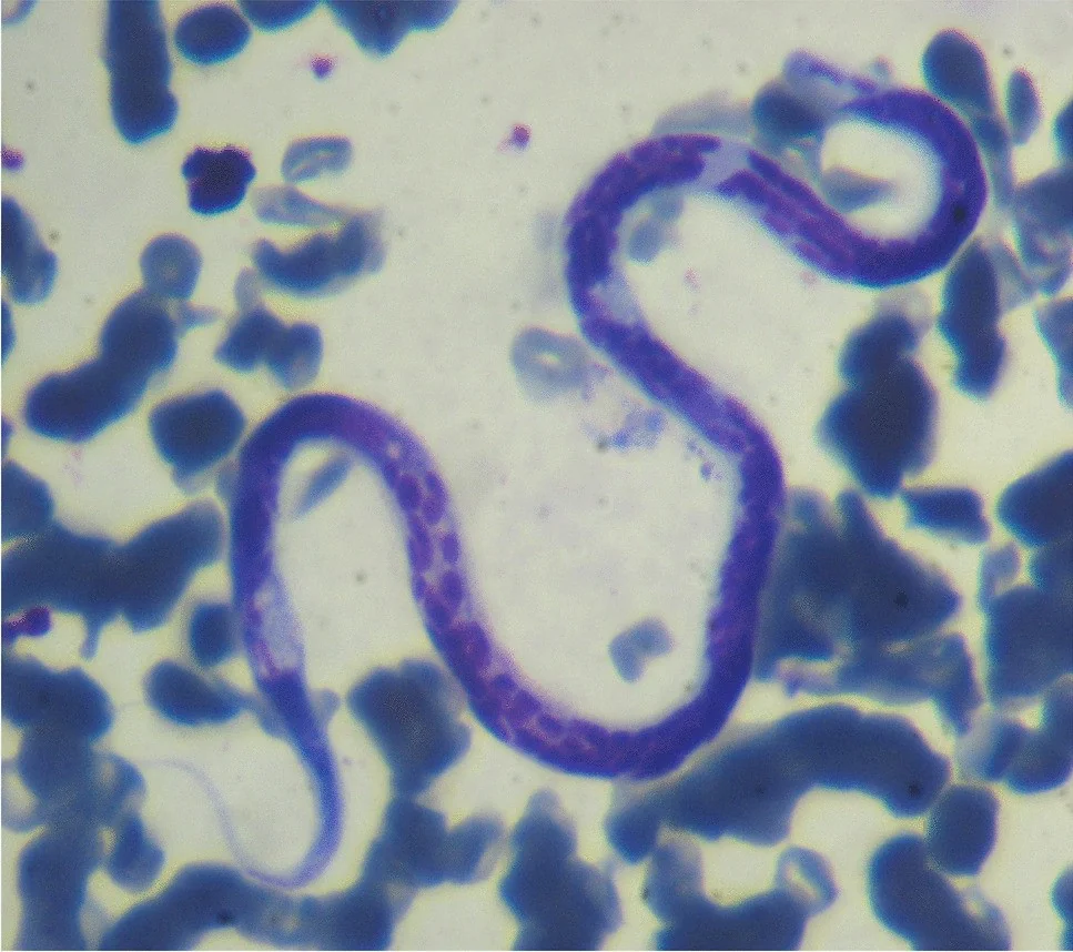 Microfilaria de Dirofilaria immitis en un frotis de sangre teñido con Giemsa, de un perro de una zona árida del oeste de Argentina.