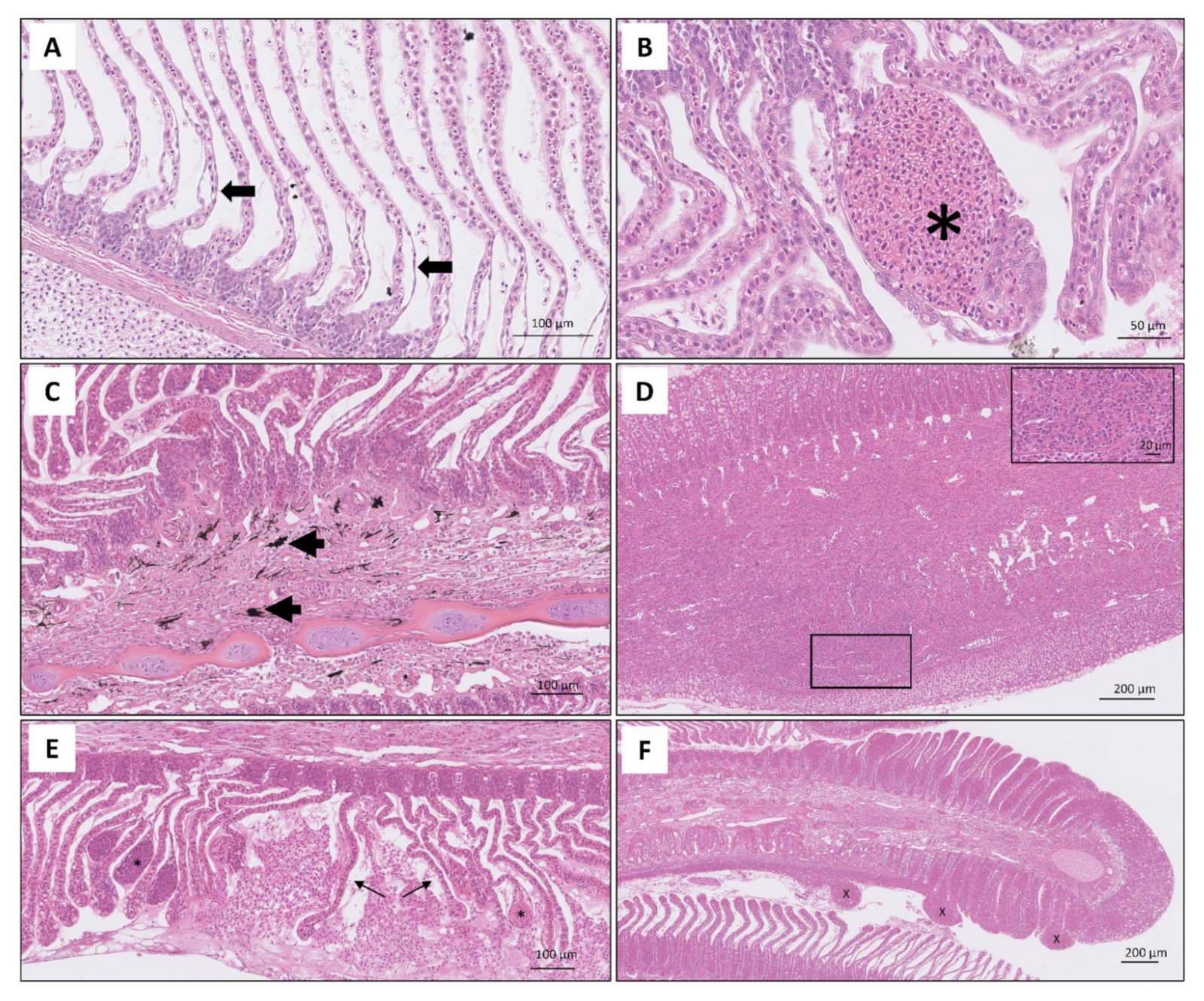 Histopatología de branquias de salmón del Atlántico en Aysén, tinción H&E. (A) Desprendimiento del epitelio de las lamelas. (B) Telangiectasia. (C) Células con melanina en el filamento. (D) Fusión de lamelas y lesión granulomatosa. (E) Telangiectasia y ruptura de lamelas. (F) Hiperplasia extensa y lesiones papilares en el extremo del filamento.