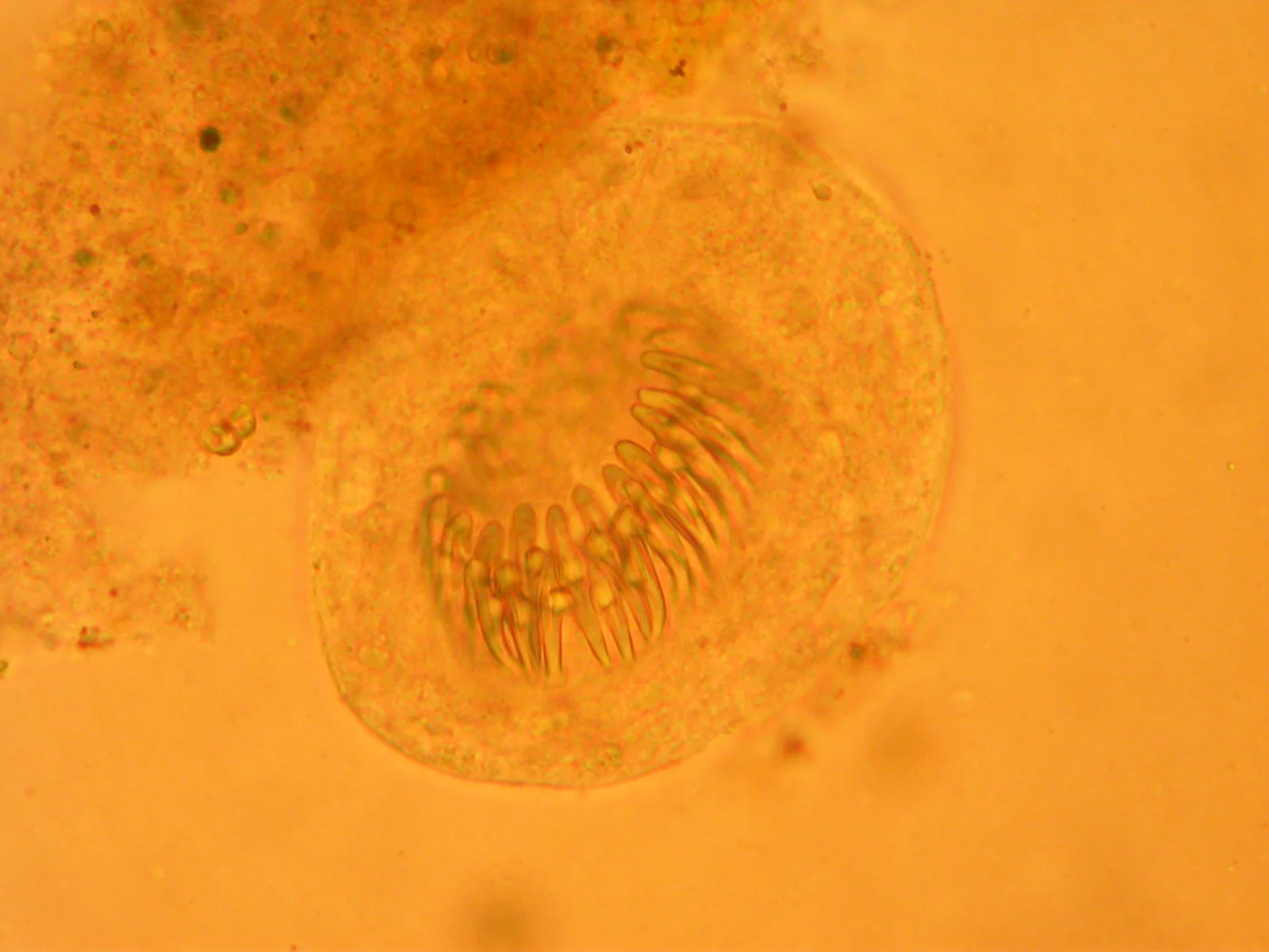 Protoescólex de Echinococcus granulosus del líquido de un quiste hidatídico, con su corona de ganchos. Cada protoescólex que el perro ingiere puede convertirse en un gusano adulto en su intestino.