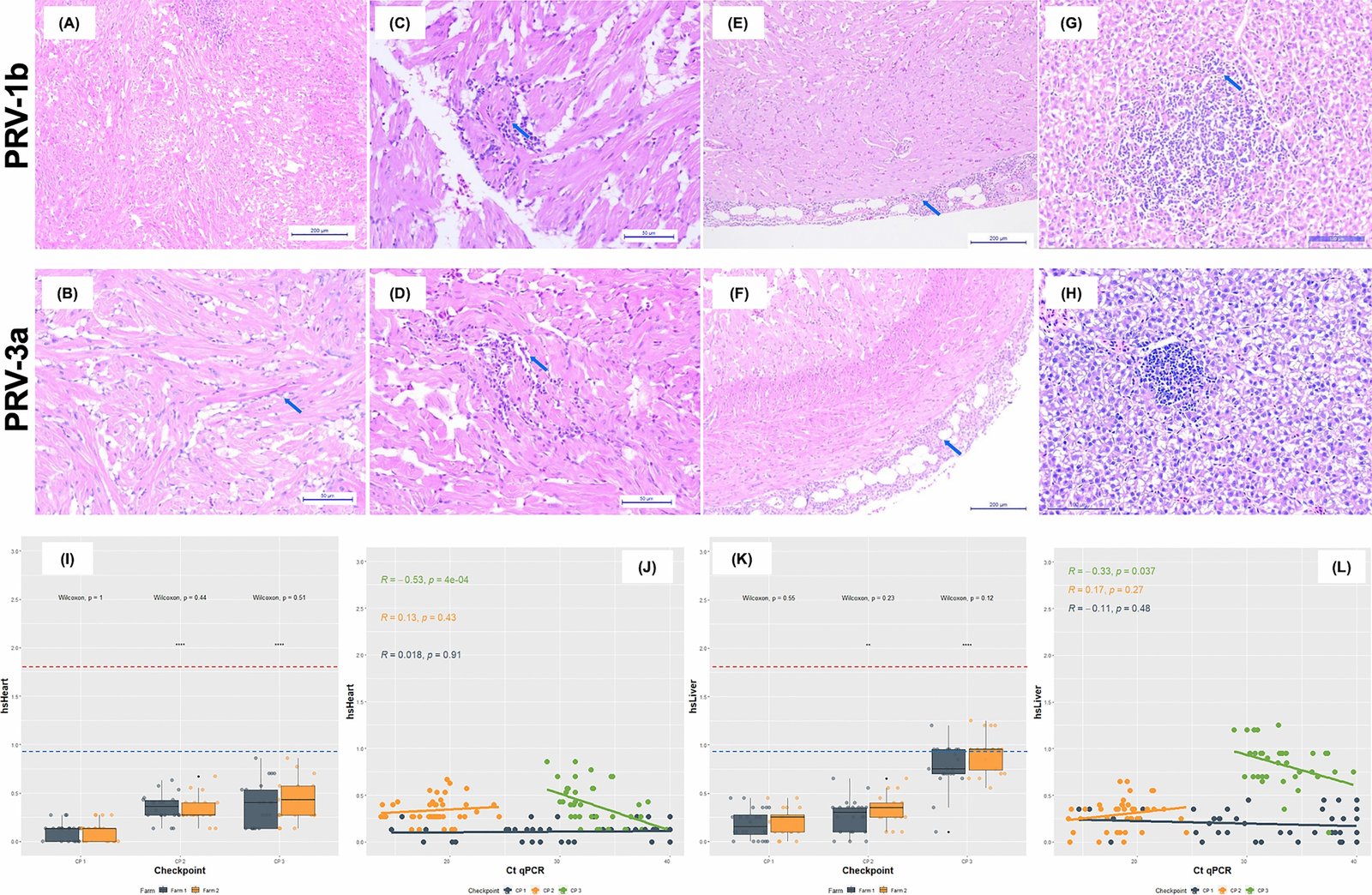 Histopatología en salmón coho infectado con PRV-1b o PRV-3a, tinción H&E. Degeneración de cardiomiocitos y miocarditis mononuclear del miocardio esponjoso, de leve a moderada; epicarditis mononuclear difusa; hepatitis mononuclear.
