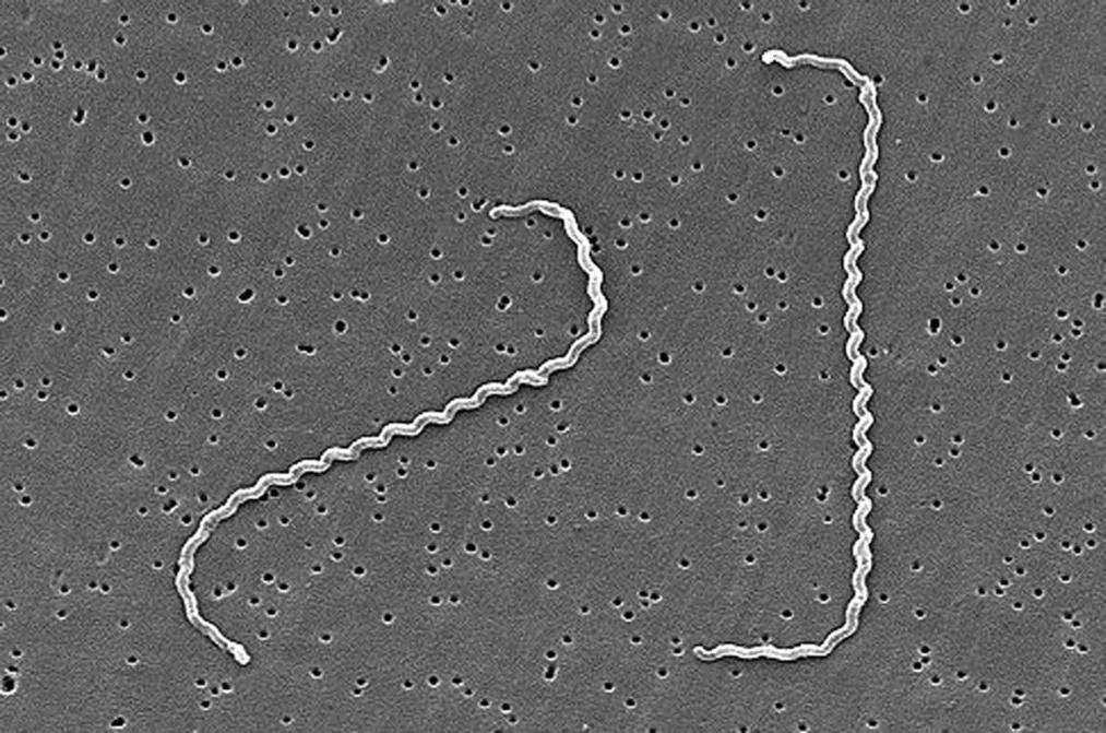 Leptospira interrogans al microscopio electrónico de barrido: espiroquetas delgadas con los extremos en gancho.
