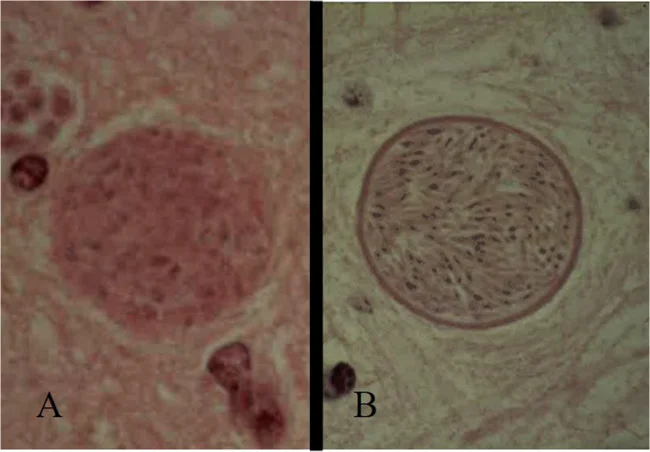 Quistes tisulares de Toxoplasma gondii (A) y Neospora caninum (B). La pared es más gruesa en Neospora (1 a 4 µm) que en Toxoplasma (menos de 0,5 µm).