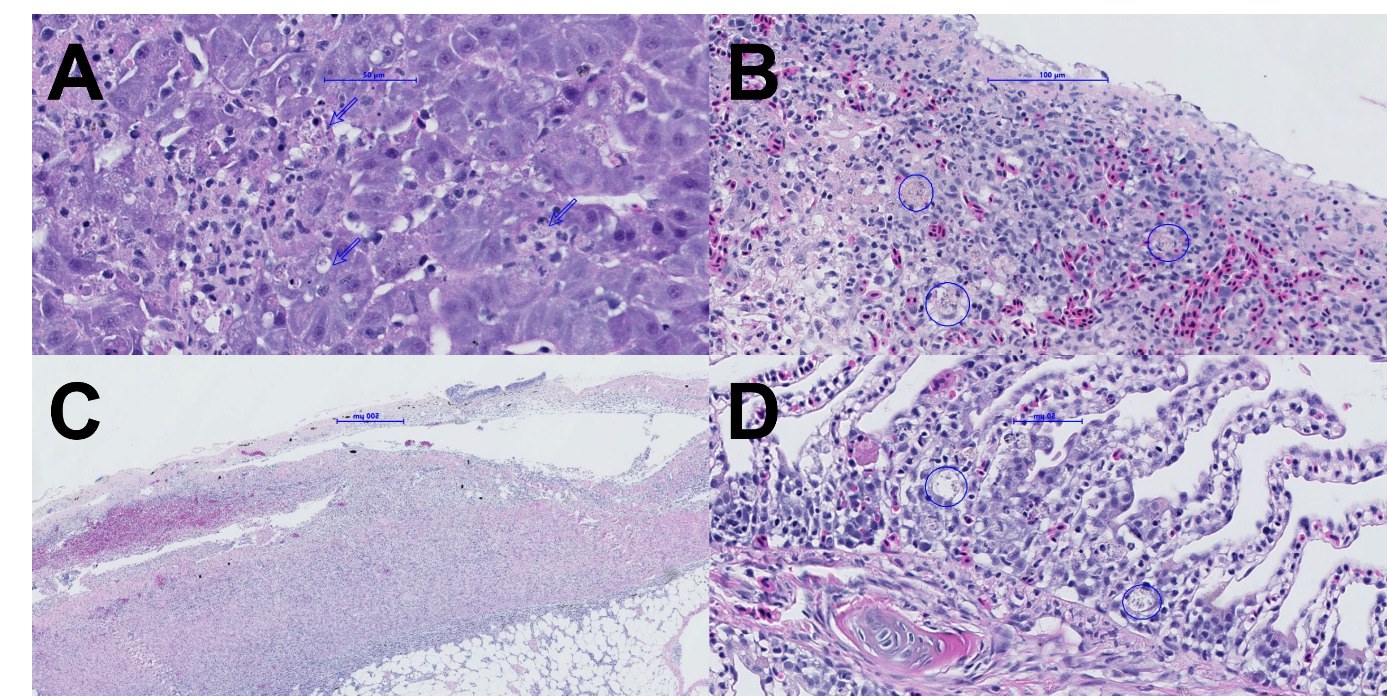 Histopatología en salmón del Atlántico con piscirickettsiosis, tinción HES. (a) Necrosis focal, inflamación y microorganismos intracelulares (flechas) en hígado. (b) Necrosis focal en bazo, pulpa roja depletada y microorganismos basófilos intracelulares. (c) Dermatitis hemorrágica con infiltrado celular en la hipodermis. (d) Branquitis focal con una célula vacuolada que contiene microorganismos.