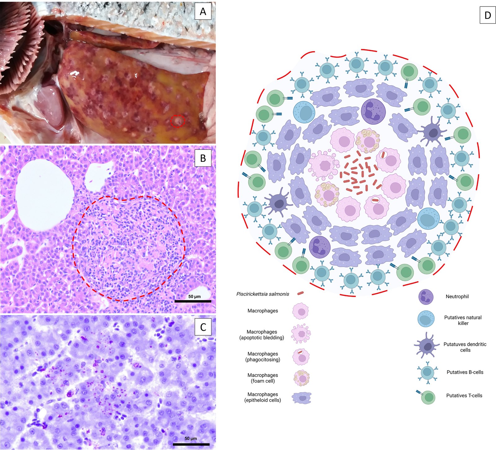 (A) Hígado pálido con áreas subcapsulares moteadas y un nódulo blanco grisáceo delimitado por la línea roja, característico de la infección. (B) Necrosis multifocal de hepatocitos, infiltrado inflamatorio y granulomas. (C) Inmunohistoquímica: P. salmonis extracelular en el centro de la necrosis e intracelular dentro de macrófagos. (D) Esquema del granuloma: necrosis central con bacterias, rodeada de macrófagos, neutrófilos y linfocitos.
