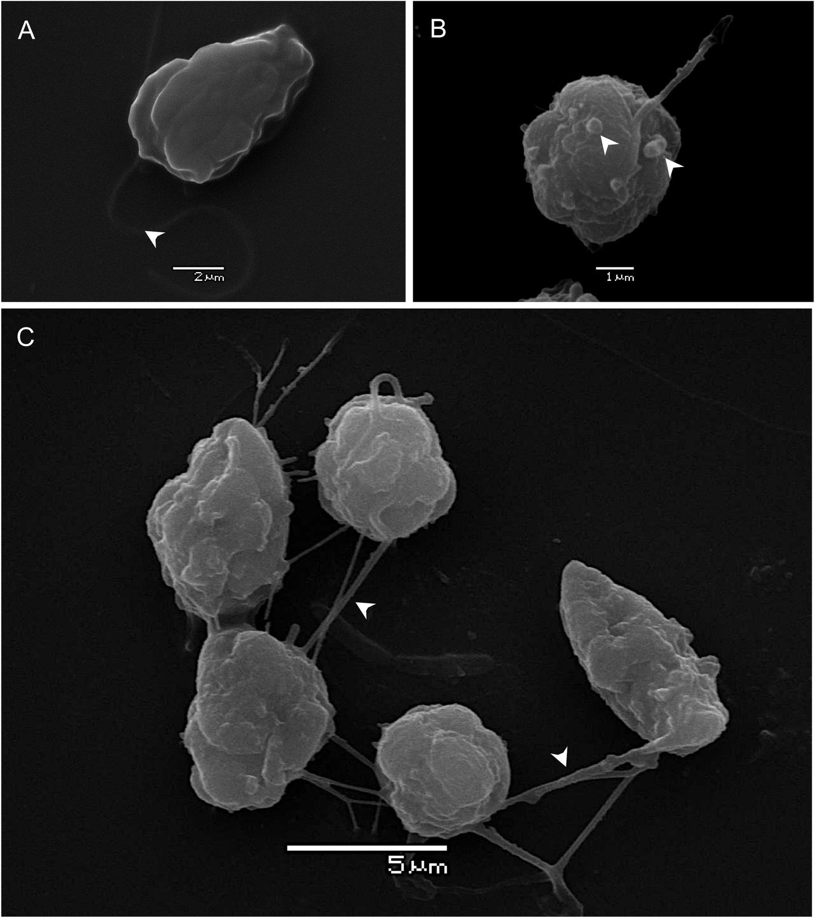 Pseudochattonella verruculosa de la cepa chilena ARC498, aislada en la floración de 2016, en microscopía electrónica de barrido. (A) Célula ovoide con un flagelo largo dirigido hacia adelante. (B) Célula esférica con mucocistos en la periferia. (C) Grupo de células unidas por filamentos de mucus.