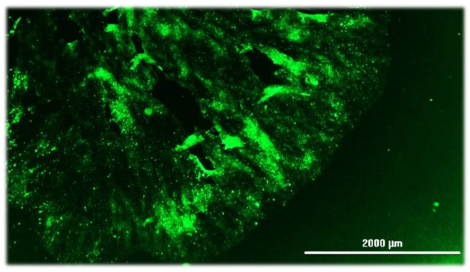 Inmunofluorescencia directa positiva en una impronta de cerebro de un gato con rabia. Es la técnica que usa el ISP para el diagnóstico confirmatorio.