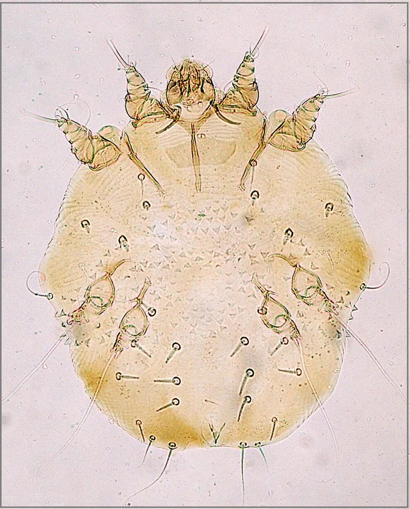 Ácaro adulto de Sarcoptes scabiei: cuerpo redondeado, patas cortas y espinas en el dorso. Vive en túneles dentro de la epidermis.