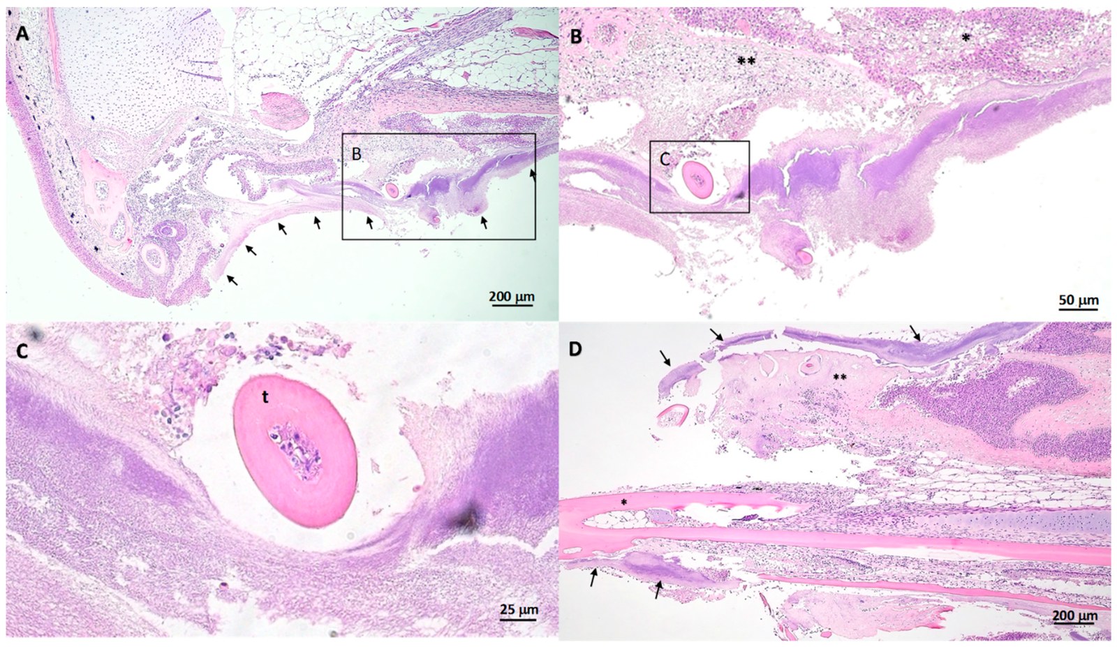 Corte sagital de mandíbula superior tras exposición a T. dicentrarchi: mantos bacterianos que reemplazan la mucosa, úlcera profunda y submucosa necrótica, con bacterias filamentosas alrededor de los dientes.