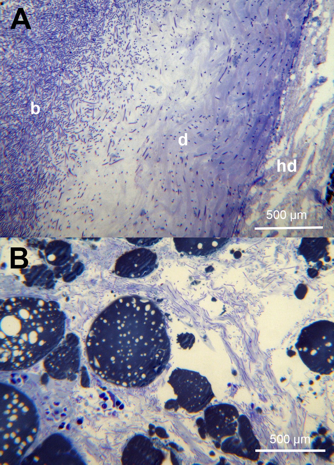 Piel de peces moribundos en un brote de campo, tinción de azul de toluidina. (A) Pérdida completa de la epidermis, con bacterias (b) que infiltran el estrato compacto de la dermis (d); la hipodermis (hd) aún sin bacterias. (B) Hipodermis con gran cantidad de bacterias.