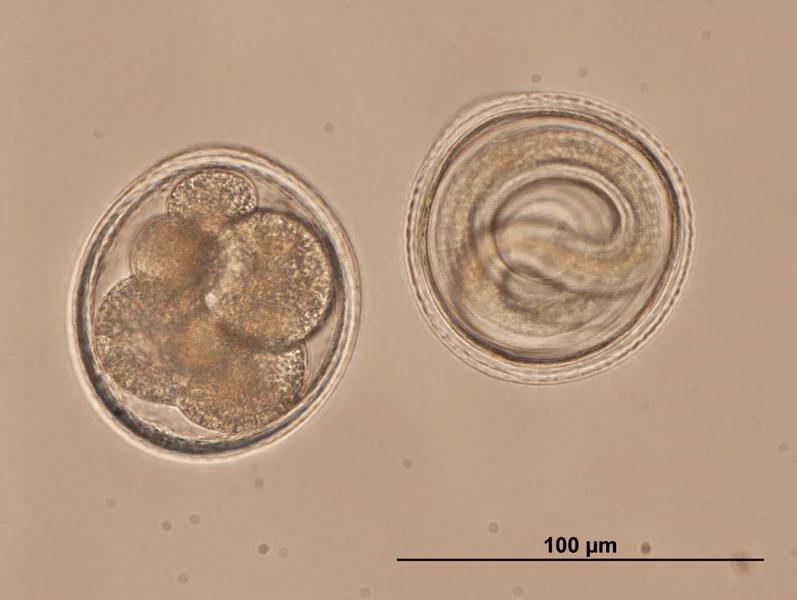 Huevos de Toxocara canis en desarrollo (x400). A la izquierda, un huevo en etapa de mórula; a la derecha, un huevo con la larva infectante ya formada. Los huevos recién eliminados no son infectantes.
