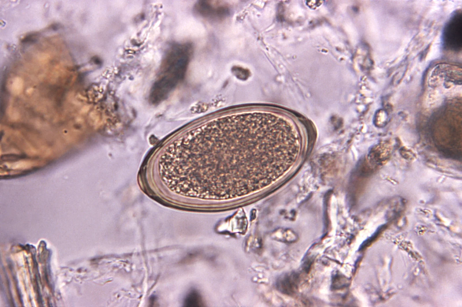 Huevo de Trichuris vulpis en una muestra de heces, con su forma de limón y un tapón en cada extremo.